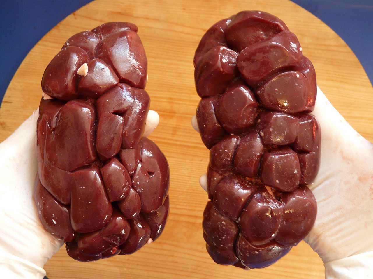 Your Kidneys Are Silent Heroes Working Overtime (image credits: pixabay)
