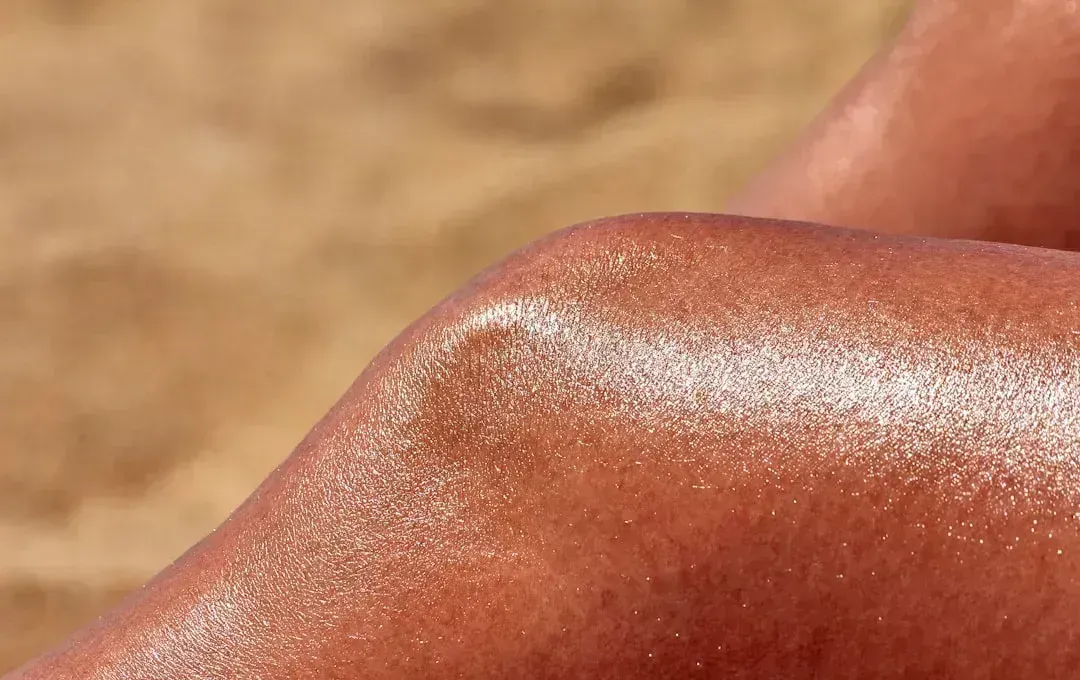 Myth 4: Cloudy Days Mean You're Safe from Sunburn (Image Credits: Unsplash)