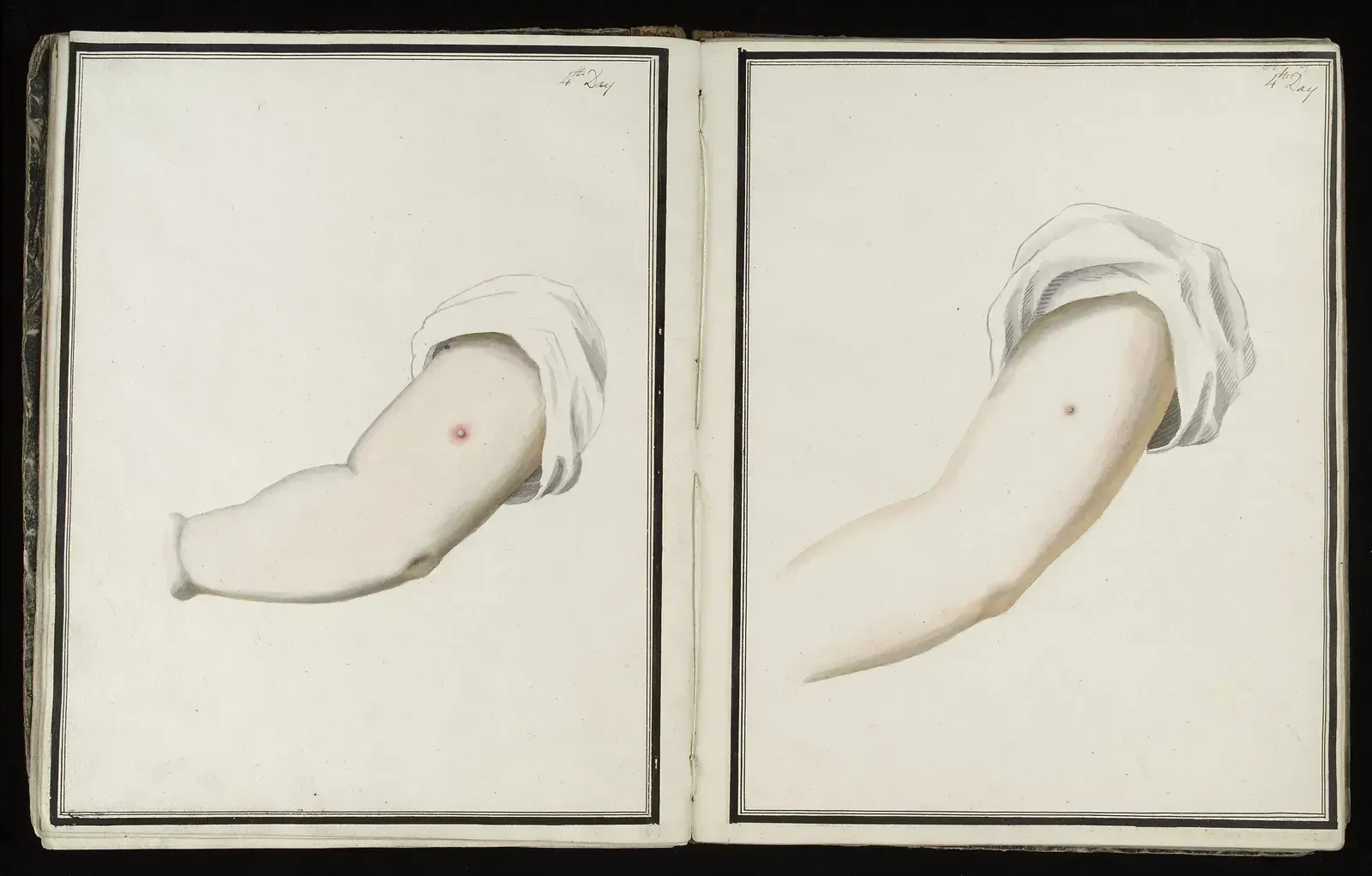 7. An enslaved man in Boston changed American medicine (Image Credits: By George Kirtland, CC BY 4.0)