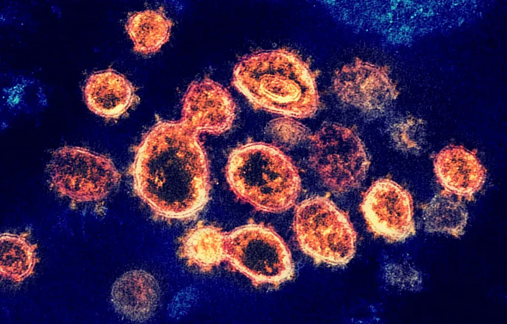 #6 - Their DNA Is Secretly Guarding the Immune System (SARS-CoV-2 (µ-IMAGE) vaccines: mRNA-1273 (moderna), Ad5 (CanSinoBio, NantKwest/ImmunityBio), ChAdOx1 nCoV-19 (Oxford university). - Other remedies: S309 (antibody), hydroxychloroquin (Malaria-medicament), fluvoxamin (Antidepressivum), famotidine(heartburn, CC BY 2.0)