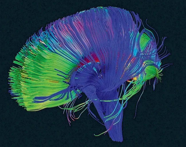 Neuroplasticity Means Your Brain Can Change (Image Credits: Flickr)