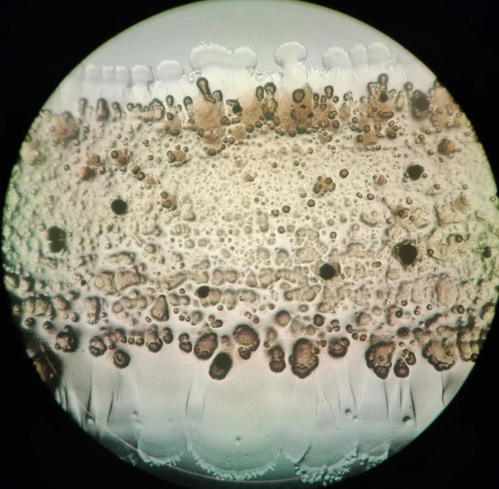 #11 - Bacteria Don't Just Inherit Genes, They Trade Them Like Baseball Cards (By Korinna, CC BY 4.0)