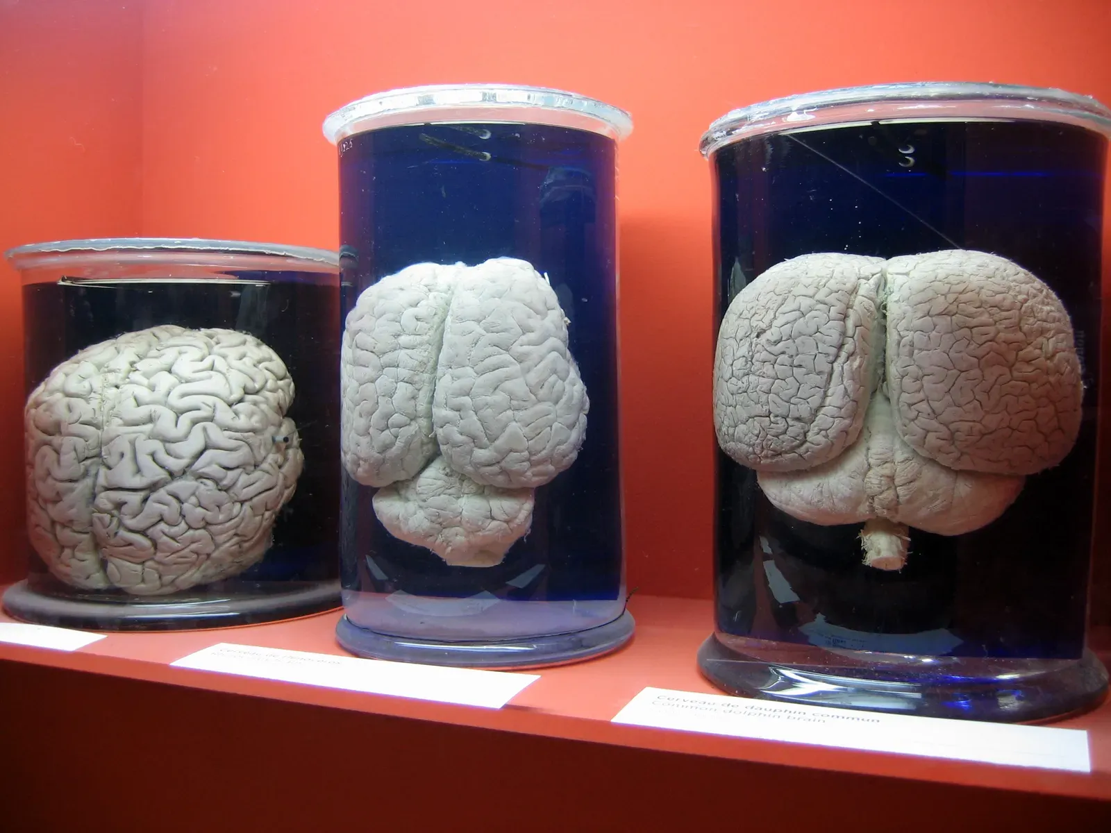#5 - Brain And Body-Part Collections Built On Eugenics Quietly Shelved (By Thesupermat, CC BY-SA 3.0)
