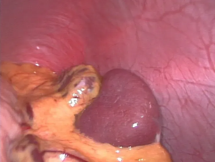 #6 - The Spleen (By Hic et nunc, CC BY-SA 3.0)