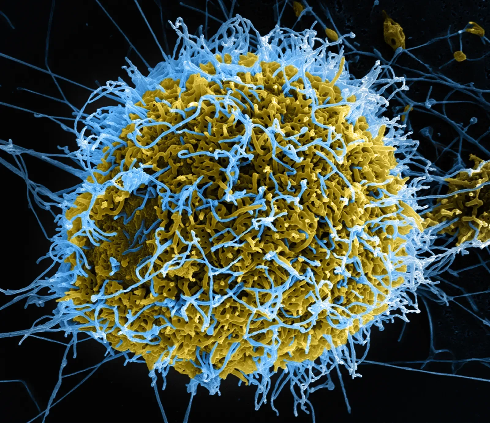 #2 - Viruses May Have Quietly Engineered Some of Evolution's Biggest Leaps (Ebola Virus Particles, CC BY 2.0)