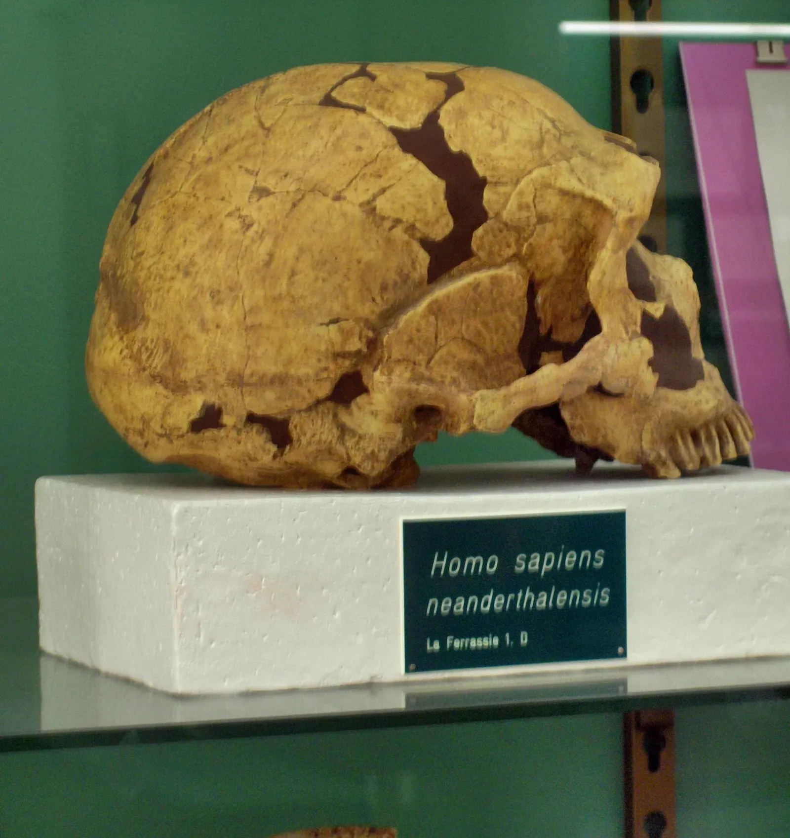 #5 - Surviving Injuries That Would Terrify a Modern Trauma Ward (Own photo by uploader at the Musée d'Anthropologie préhistorique of Monaco, CC BY 3.0)