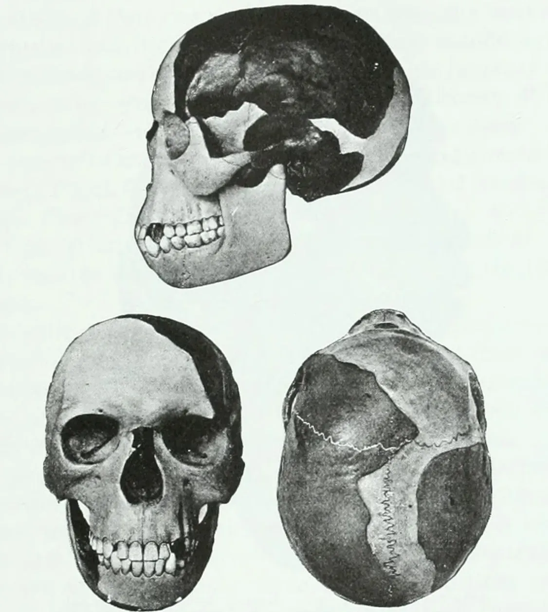 #12 - The "Piltdown Man" Fossil That Rewrote Human Evolution... Then Collapsed (Image Credits: Wikimedia)