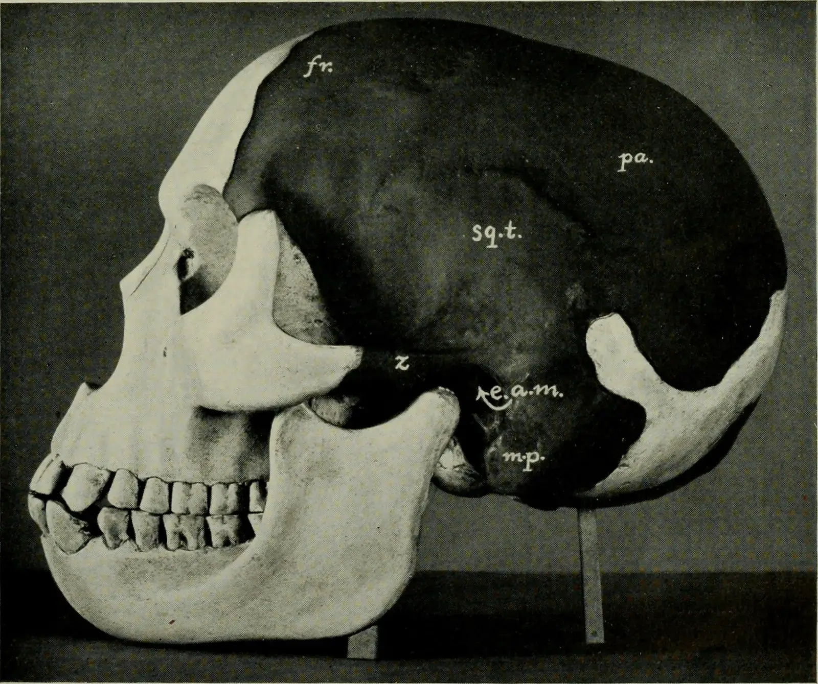The Piltdown Man: The Crown Jewel of Scientific Fraud (Image Credits: Wikimedia)