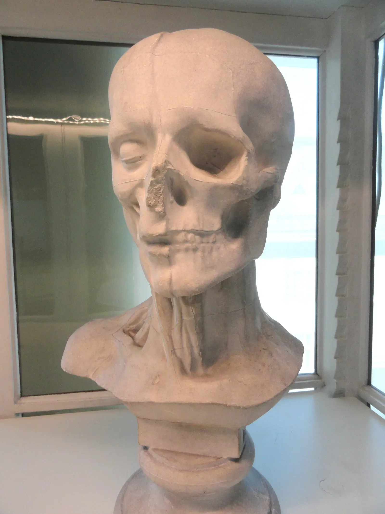 #4 - Anatomical "Curiosities" Mixing Race, Disability, And Death (By Daderot, CC0)