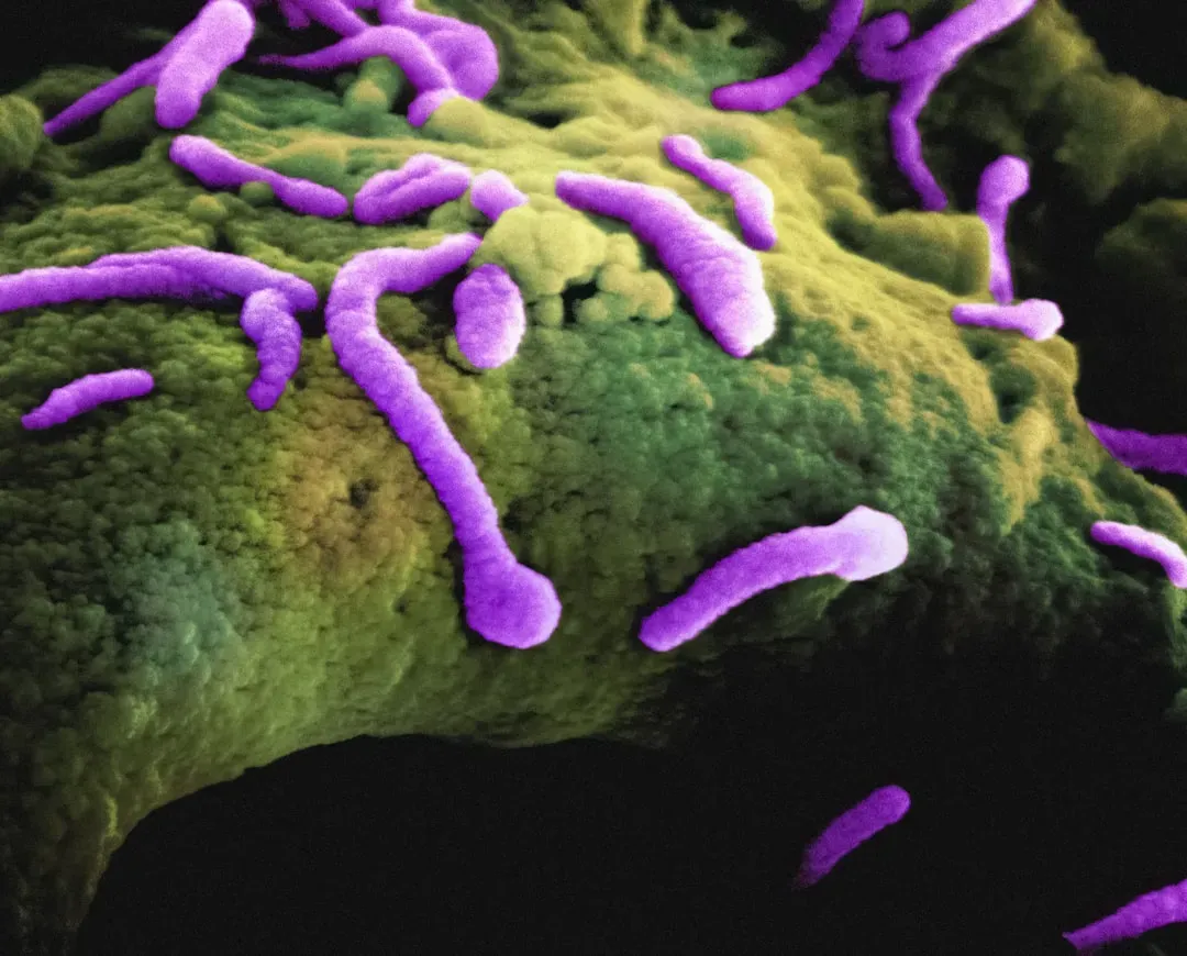 Some of the Oldest Life Forms Prefer Boiling, Acidic, or Toxic Environments (Image Credits: Unsplash)