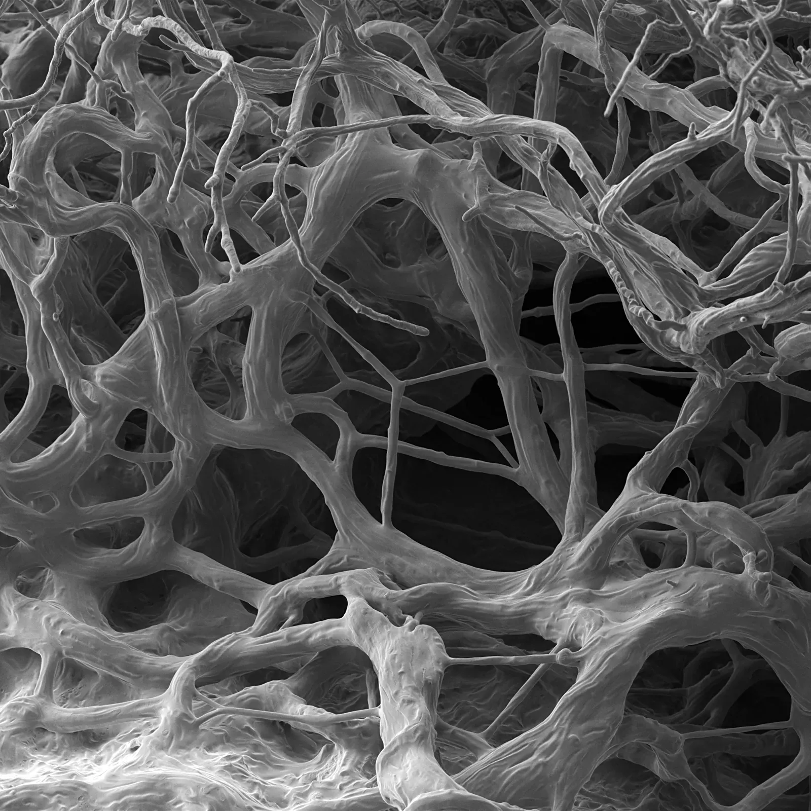 Extreme Strategies for Extreme Times (Image Credits: Wikimedia)