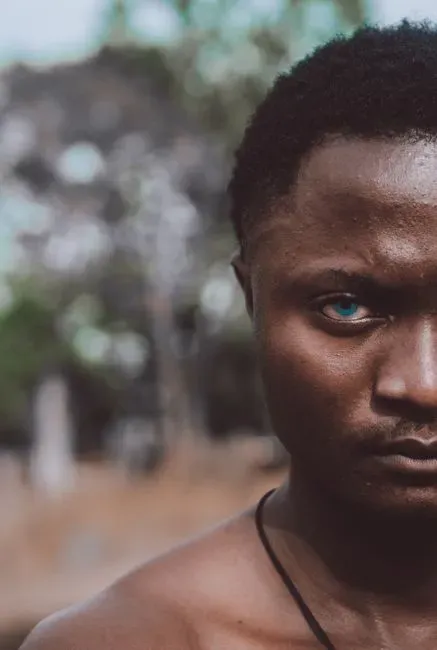 #7 - Dark Skin and Blue Eyes: A Combination Nobody Expected (Image Credits: Pexels)