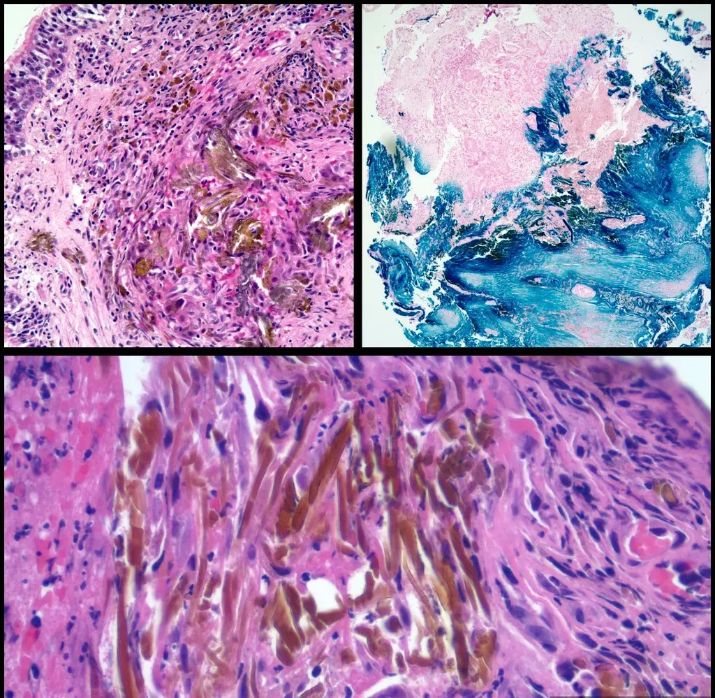 #5 - The Staining Method That Misled an Entire Subfield (Y Rosen, MD & P Meseguer, MD, Flickr, CC BY-SA 2.0)