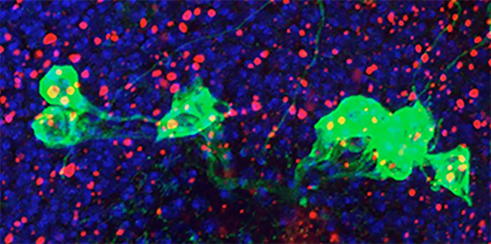 #3 - Adults Were Told They Could Never Grow New Brain Cells (Fly Brain Cells, Public domain)