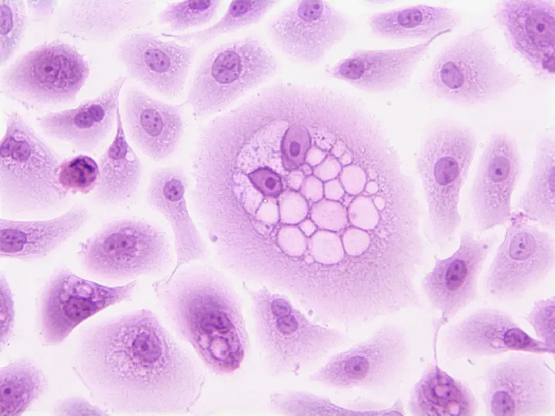 From Microbes to Multicellular Life: A Catalyst for Complexity (Image Credits: Unsplash)