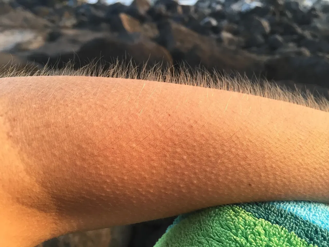 Why Some People Get More Chills Than Others (And What That Might Mean) (Image Credits: Pixabay)