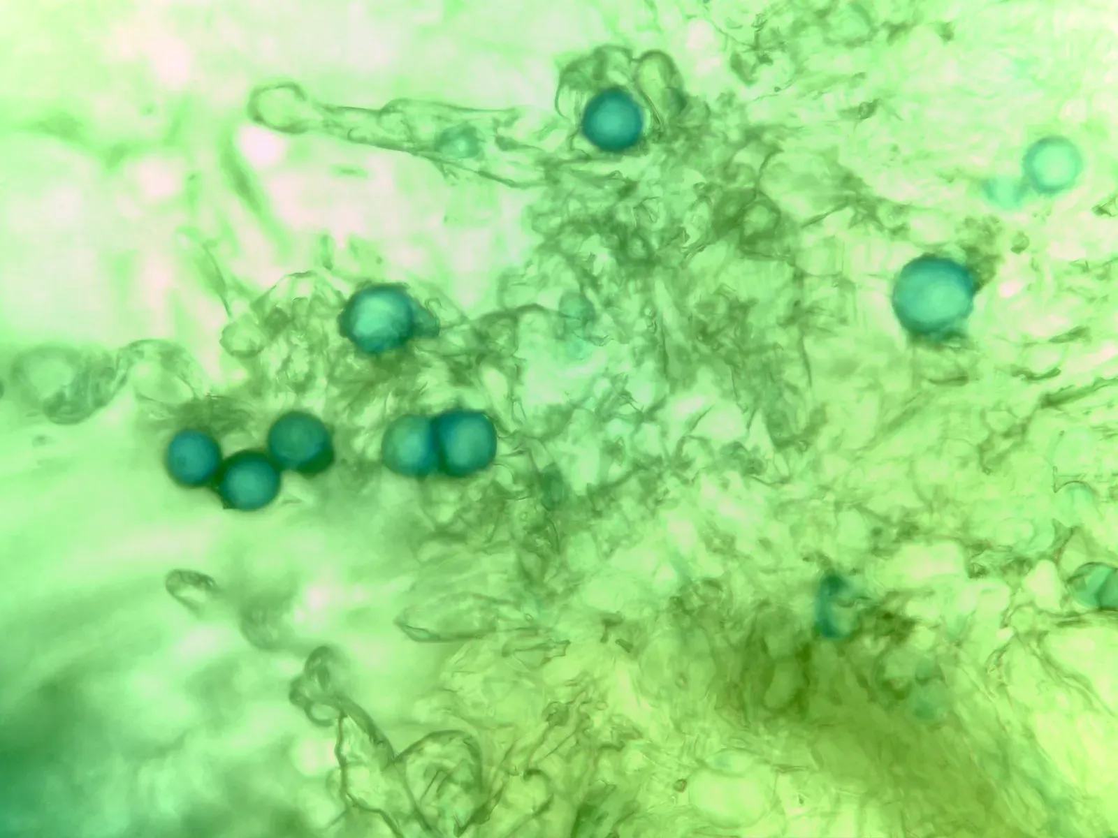 #3 Ancient Pollen and Microscopic Plant Traces (By Ergriffi, CC BY 4.0)