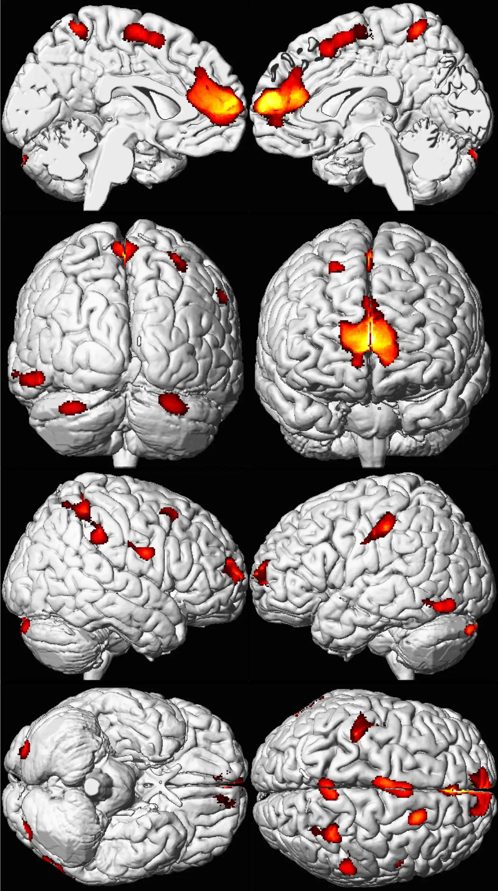 Spatial and Verbal Abilities Reveal Cognitive Strengths (Image Credits: Wikimedia)