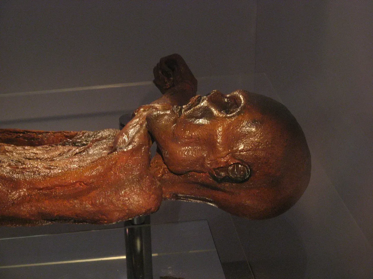 #7 - The World's Oldest Known First-Aid Kit (Image Credits: Pixabay)