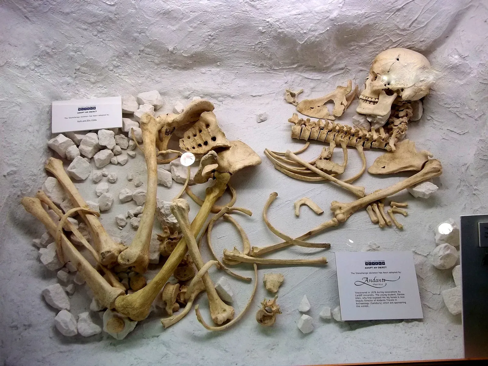 #13 - Human Remains Pulled From Public View, Almost Overnight (By Pasicles, CC0)
