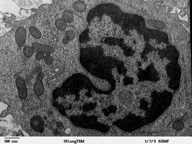 #12 - Fungi and Pollen Buried Deep in the Lungs (By Louisa Howard, Public domain)
