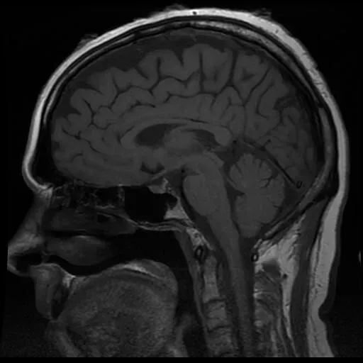 The spinal cord and brainstem: old hardware, fast decisions (hatcher10027, Flickr, CC BY 2.0)