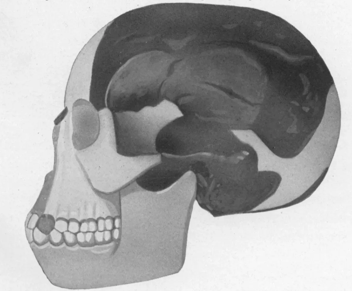 #1 - Piltdown Man: The 40-Year Missing Link That Wasn't (Image Credits: Wikimedia)