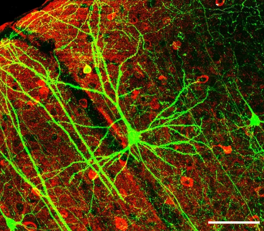 7. Memory and Learning: Nervous Systems That Change Themselves (Dynamic Remodeling of Dendritic Arbors in GABAergic Interneurons of Adult Visual Cortex.  Lee WCA, Huang H, Feng G, Sanes JR, Brown EN, et al. PLoS Biology Vol. 4, No. 2, e29.  doi:10.1371/journal.pbio.0040029, Figure 6f, slightly altered (plus scalebar, minus letter "f".), CC BY 2.5)