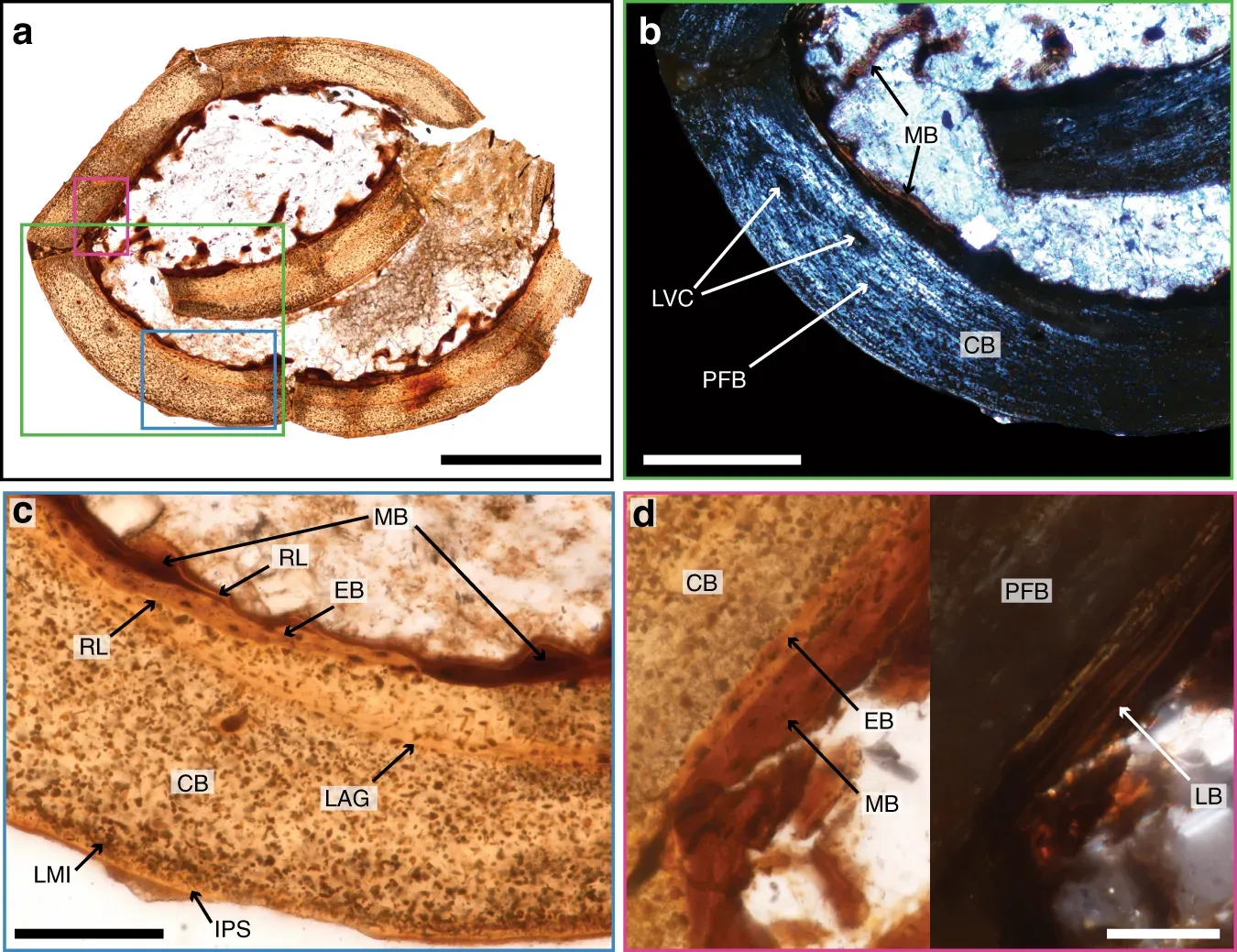 How Ancient DNA Turned Tiny Fossils into a Big Discovery (By Alida M. Bailleul[1]
References↑ Bailleul, Alida M. (20 March 2019). "An Early Cretaceous enantiornithine (Aves) preserving an unlaid egg and probable medullary bone". Nature Communications 10. DOI:10.1038/s41467-019-09259-x. Retrieved on 22 March 2019., CC BY-SA 4.0)