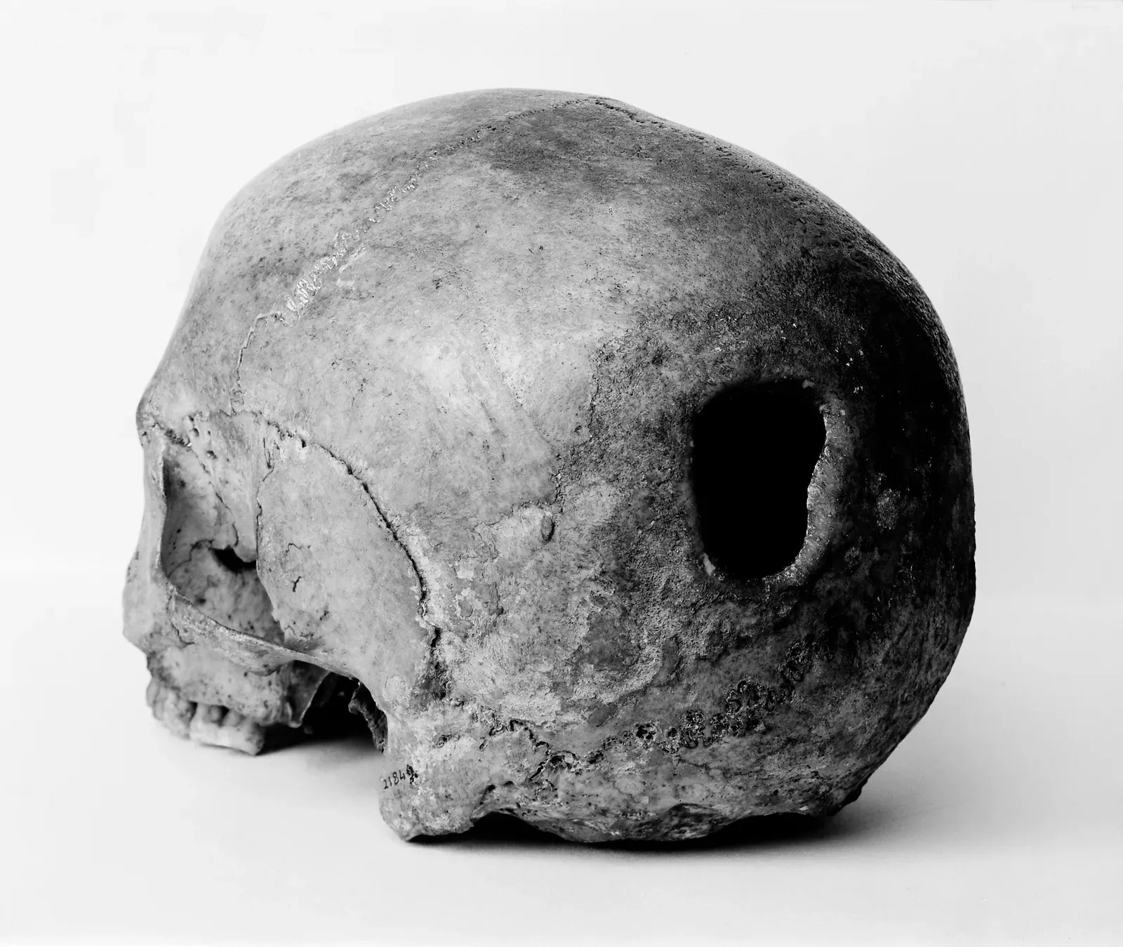 1. Stone Age people performed shockingly advanced brain and skull surgery (CC BY 4.0)