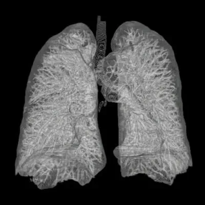 6. Breathing on Land: Lungs, Tracheae, and Odd Halfway Solutions (By AndreasHeinemann at Zeppelinzentrum Karlsruhe, Germany http://www.rad-zep.de, CC BY 2.5)