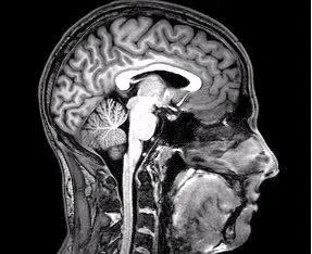 The Brain Is a Story-Making Machine, Not a History Recorder (By DrOONeil, CC BY-SA 3.0)