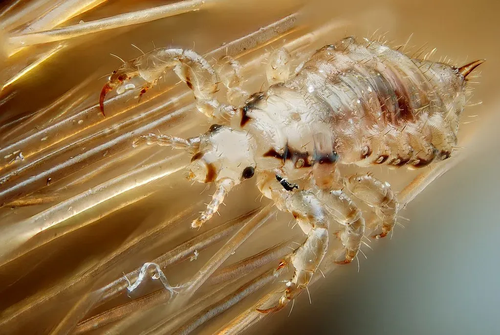 Head Lice: The Unwanted Inheritance From Our Ancestors (Image Credits: Flickr)