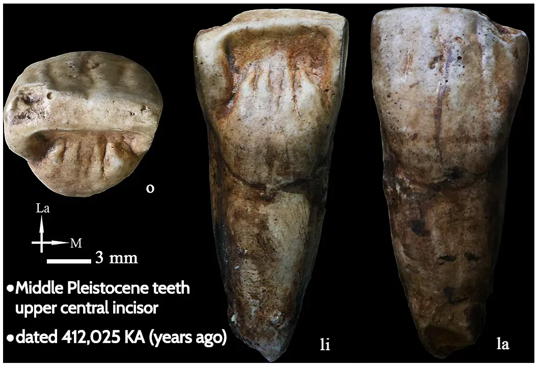 #10 - The Teeth That Walked Beside Lucy's Cousins (By https://journals.plos.org, CC BY-SA 4.0)