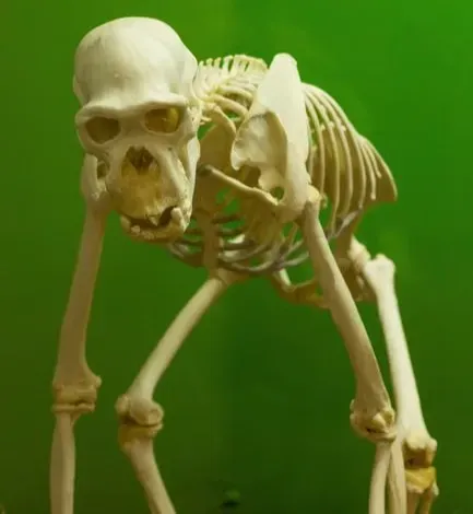 #13 - The Permanently Bent "Ape-Man" Posture (Image Credits: Pexels)