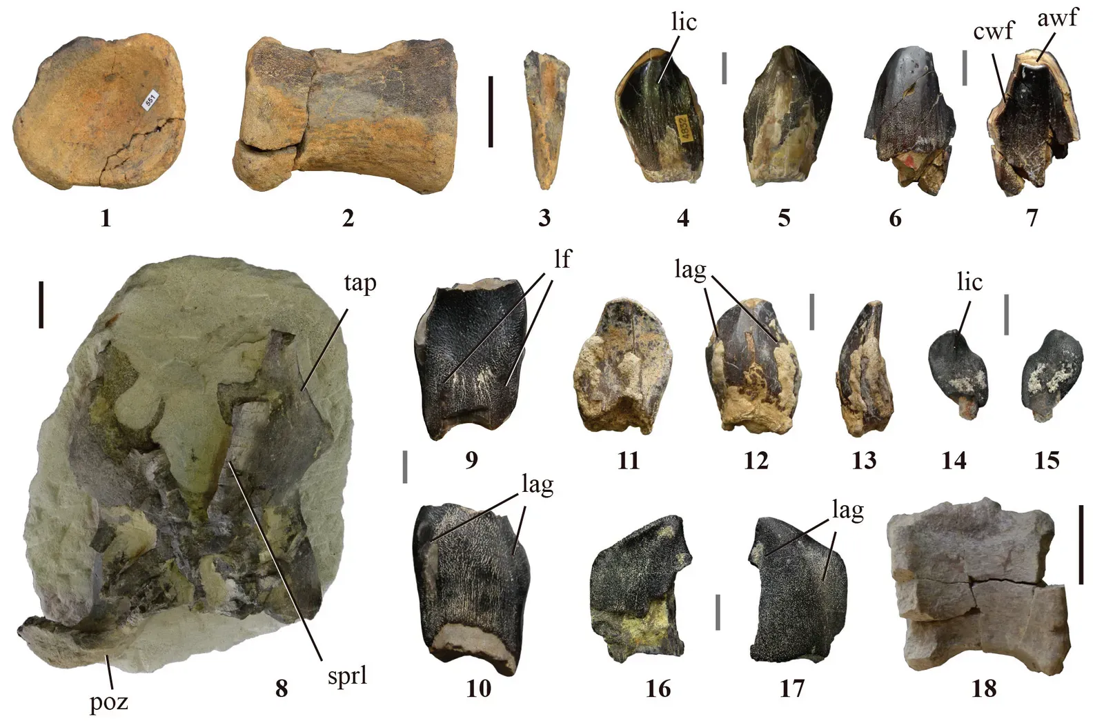 Their Hearts Were Under Incredible Pressure (Image Credits: Wikimedia)