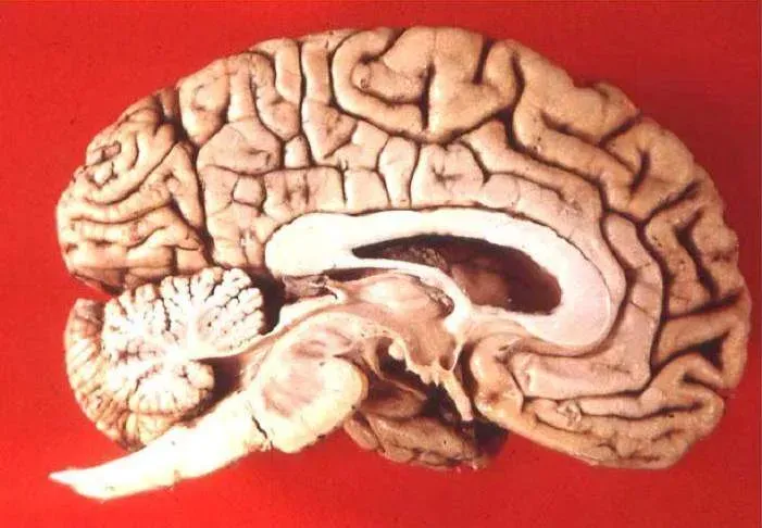 Smaller Guts, Bigger Brains: The Expensive Tissue Trade (By John A Beal, PhDDep't. of Cellular Biology & Anatomy, Louisiana State University Health Sciences Center Shreveport, CC BY 2.5)