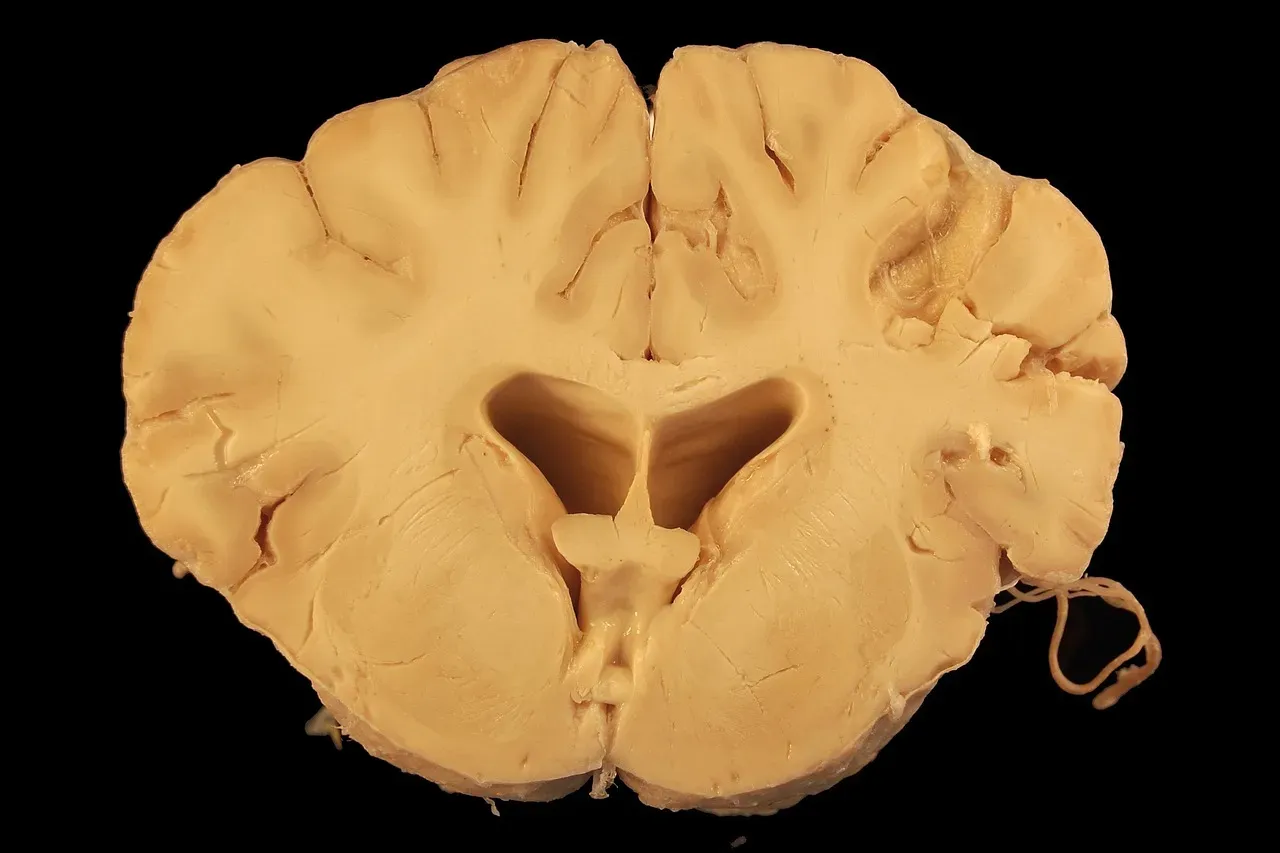 #2: Raw Animal Brains, Prions and All (Image Credits: Pixabay)