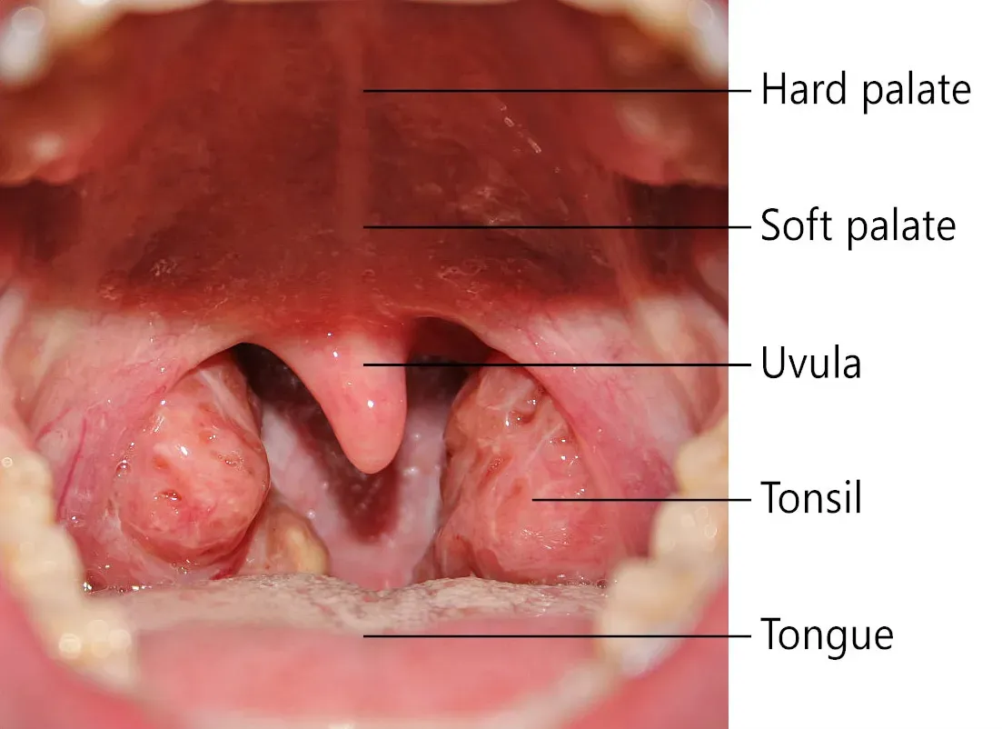 #2 - The Tonsils (By Klem, CC BY 3.0)