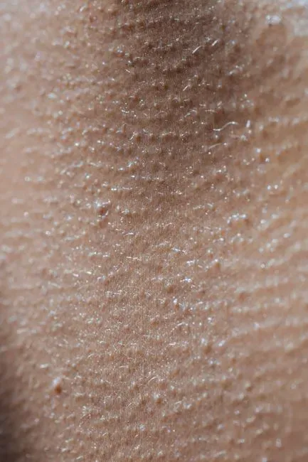 What Actually Happens During Goosebumps? (Image Credits: Pexels)