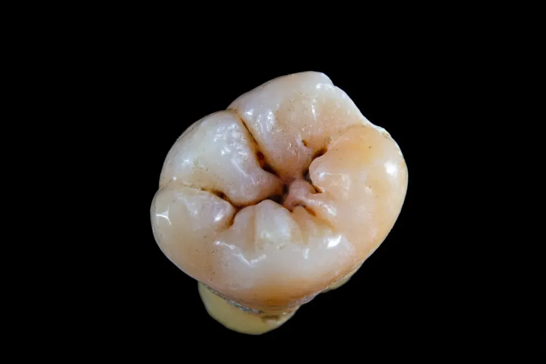 The Tribosphenic Molar: Nature's Multi-Tool Tooth (Image Credits: Unsplash)