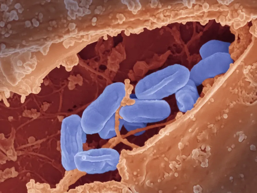 #7 - Bacteria That "Pickled" the Body From the Inside Out (Image Credits: Unsplash)