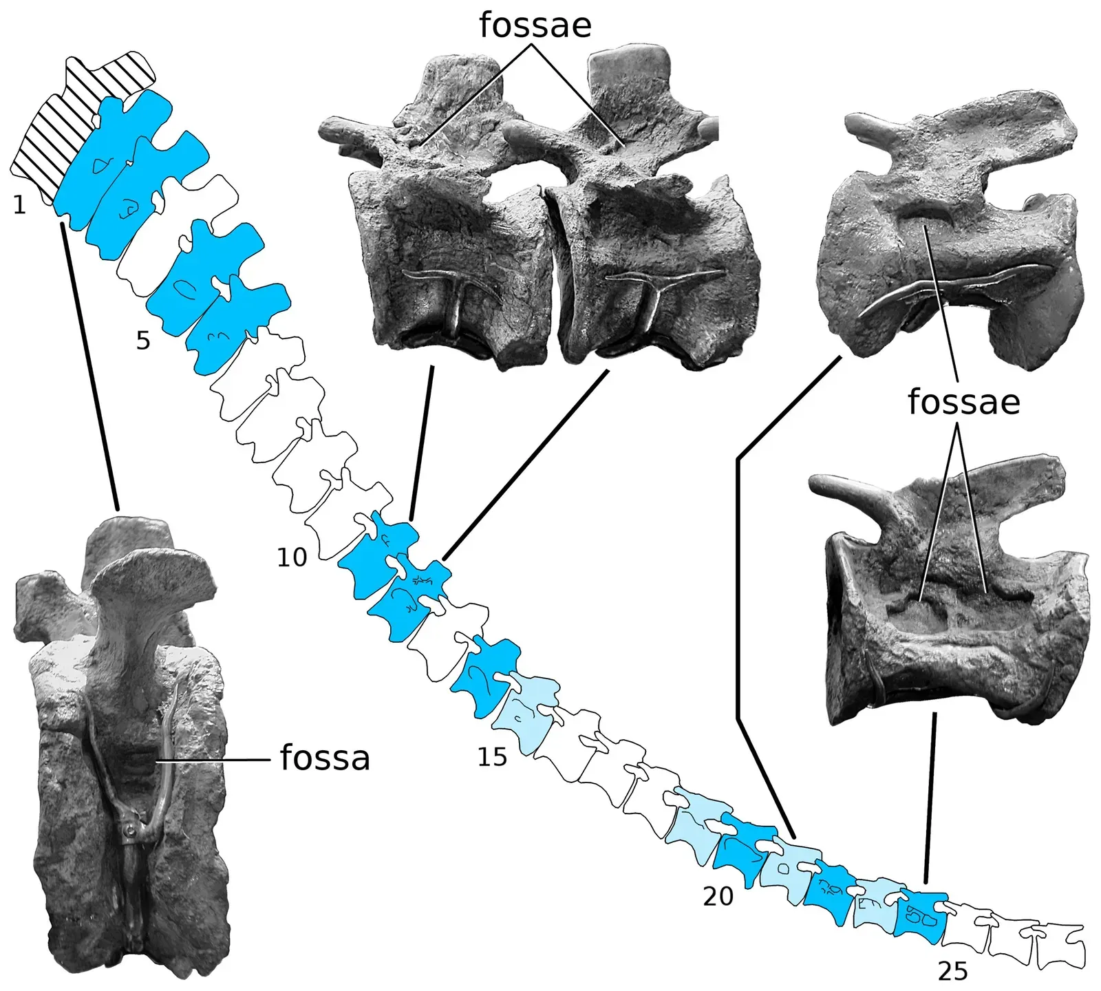 Parasites and Respiratory Illness Hidden in Dinosaur Bones (Wedel MJ, Taylor MP (2013) Caudal Pneumaticity and Pneumatic Hiatuses in the Sauropod Dinosaurs Giraffatitan and Apatosaurus. PLoS ONE 8(10): e78213. doi:10.1371/journal.pone.0078213, CC BY 3.0)