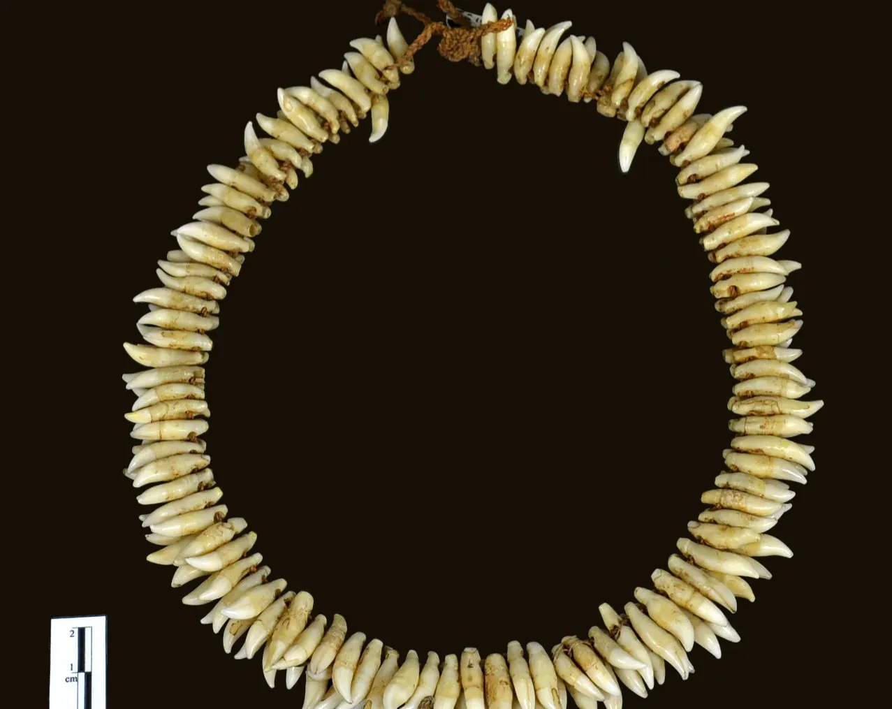 #4 - Hundreds of Fox Canine Teeth Sewn Into Belts (Image Credits: Wikimedia)
