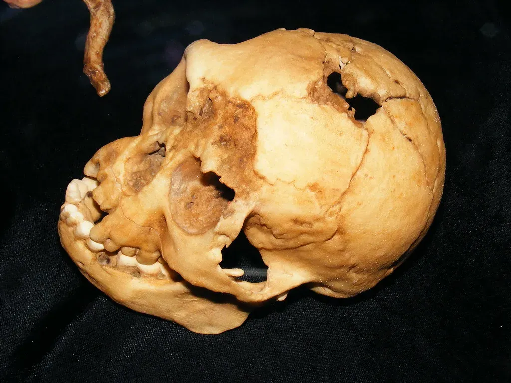 #4 - Homo floresiensis, "The Hobbit" (Flores, Indonesia) (Mamoritai, Flickr, CC BY-SA 2.0)