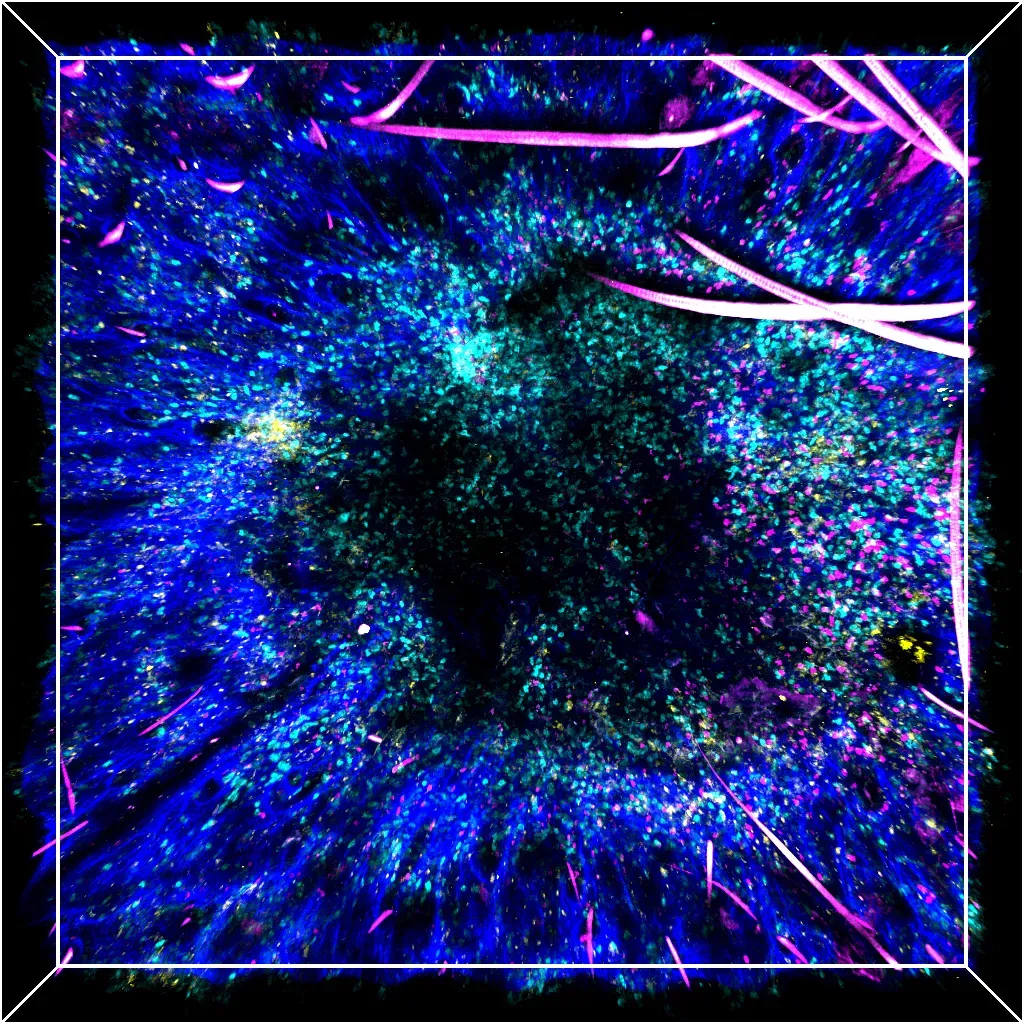 Your Skin's Invisible Army of Bacterial Protectors (Image Credits: Wikimedia)