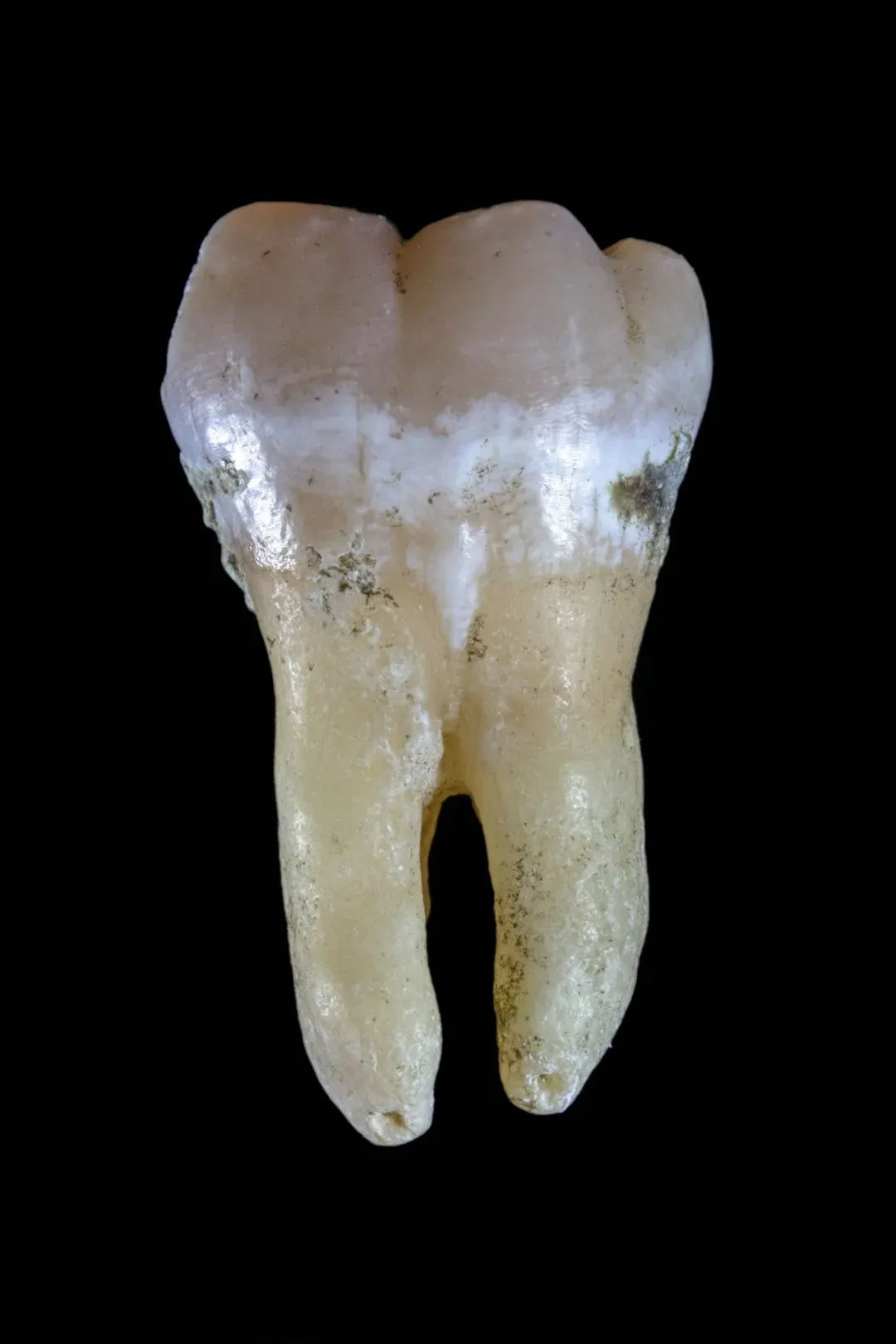 #2 - Tooth Shape Reveals Ancestry Better Than Almost Any Other Bone (Image Credits: Unsplash)