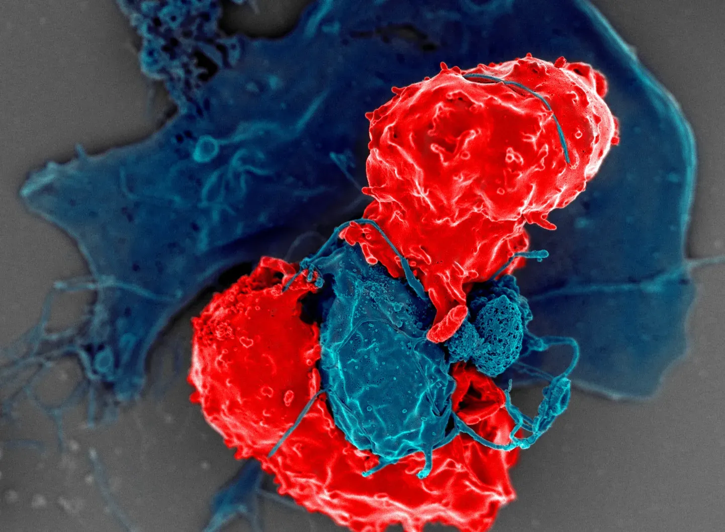 Cellular Assassins: Natural Killer Cells And Phagocytes (Image Credits: Wikimedia)