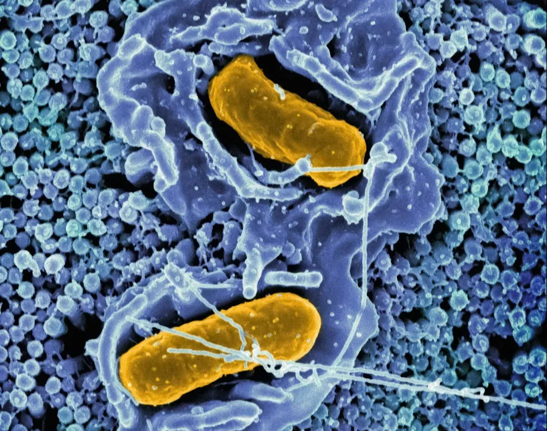 The Gut–Brain Connection: Your “Second Brain” (Image Credits: Unsplash)