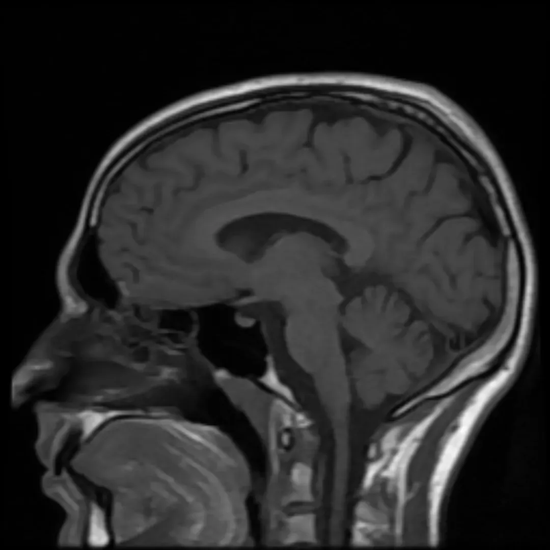 From Freud to fMRI: A History of Chasing Dreams (Image Credits: Wikimedia)